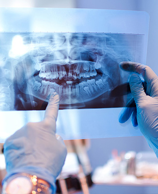 The image shows a dental professional examining an X-ray of a patient s teeth and mouth using a magnifying glass, with the X-ray placed on a light box.