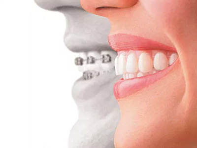 Tranquil Dental | Dentures, Botox reg  and Night Guards