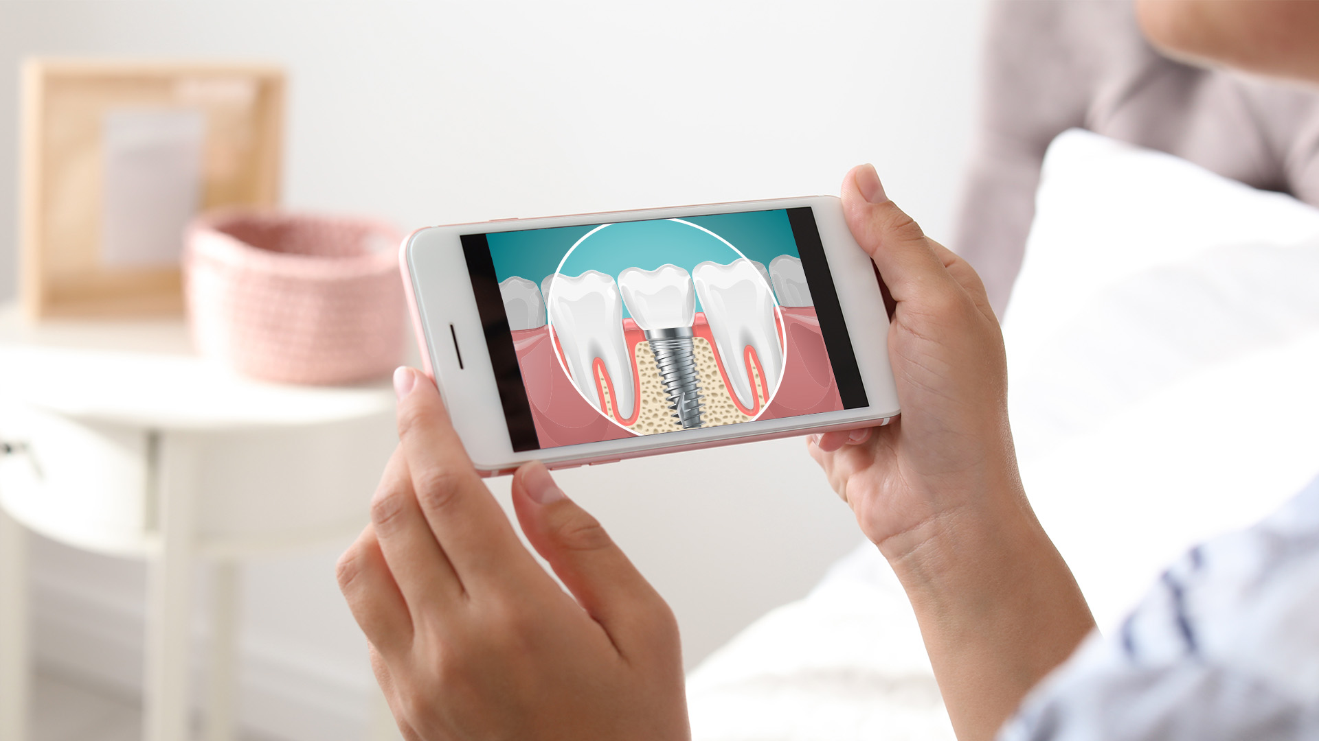 A person holding a smartphone displaying an image of a tooth with a root canal treatment, suggesting dental care or education.