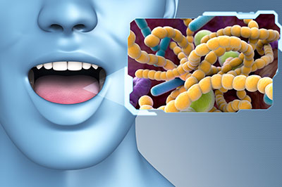 The image depicts a 3D rendering of a human head with an open mouth, displaying a white substance that resembles bacteria or viruses. There is a graphic overlay on the right side showing a microscopic view of what appears to be bacterial cells with different colored components.