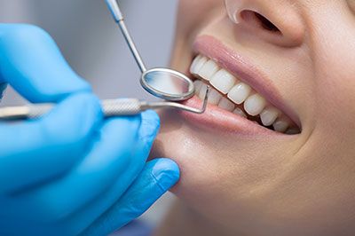 A dental hygienist performing a teeth cleaning procedure on a patient, with the patient s mouth open and the hygienist using a dental mirror and tools.