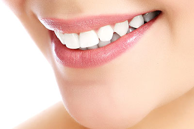 The image shows a close-up of a person s face with a focus on their teeth, which are enhanced by a cosmetic dental procedure.