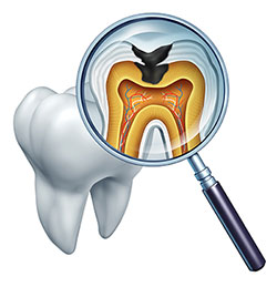 The image shows a magnified view of a human tooth with the visible crown and root, along with an open mouth revealing teeth and gums. A dental mirror is held up to the tooth, reflecting its internal structure including the pulp chamber and roots, as well as the surrounding oral cavity.