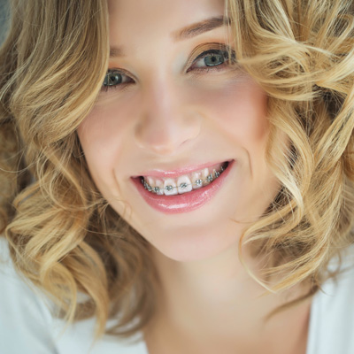 Woman with braces, smiling at the camera.