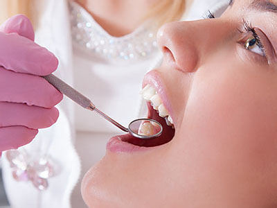 A dental professional is performing oral care on a patient, with a focus on the process of cleaning teeth.