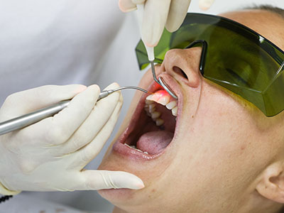 A person receiving dental treatment, with a dental professional performing the procedure.